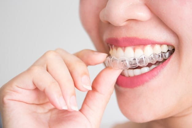 Discover The Perks Of Straight Teeth With Invisalign!