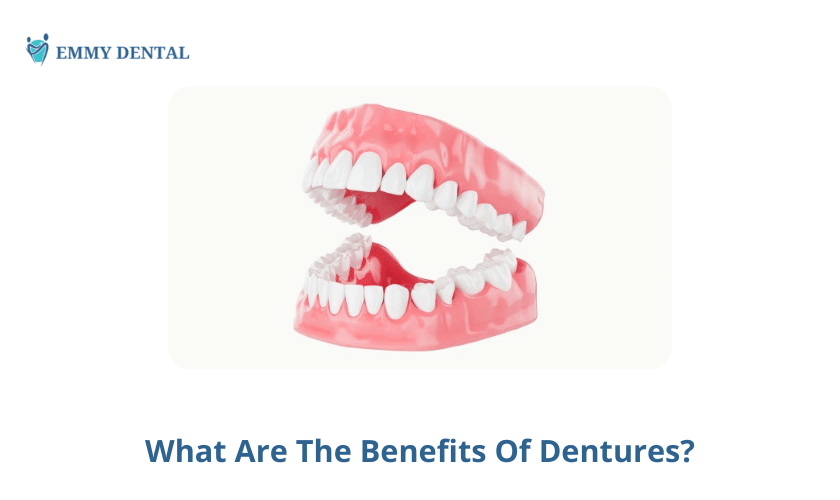 What Are The Benefits Of Dentures?