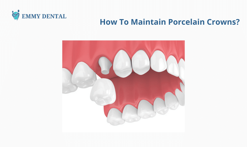 How To Maintain Porcelain Crowns?