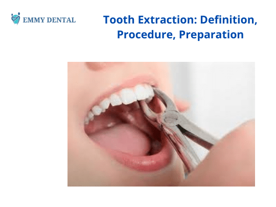 excursion tooth definition