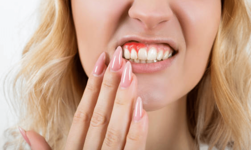 Oral Health Could Lead To Serious Disease