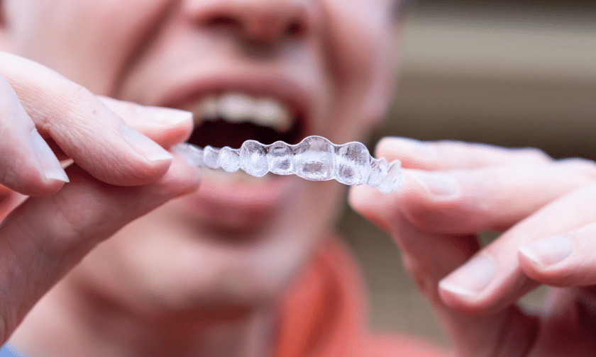 Invisalign