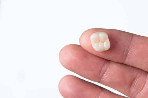 Featured image for “5 FAQs About CEREC® Crowns”