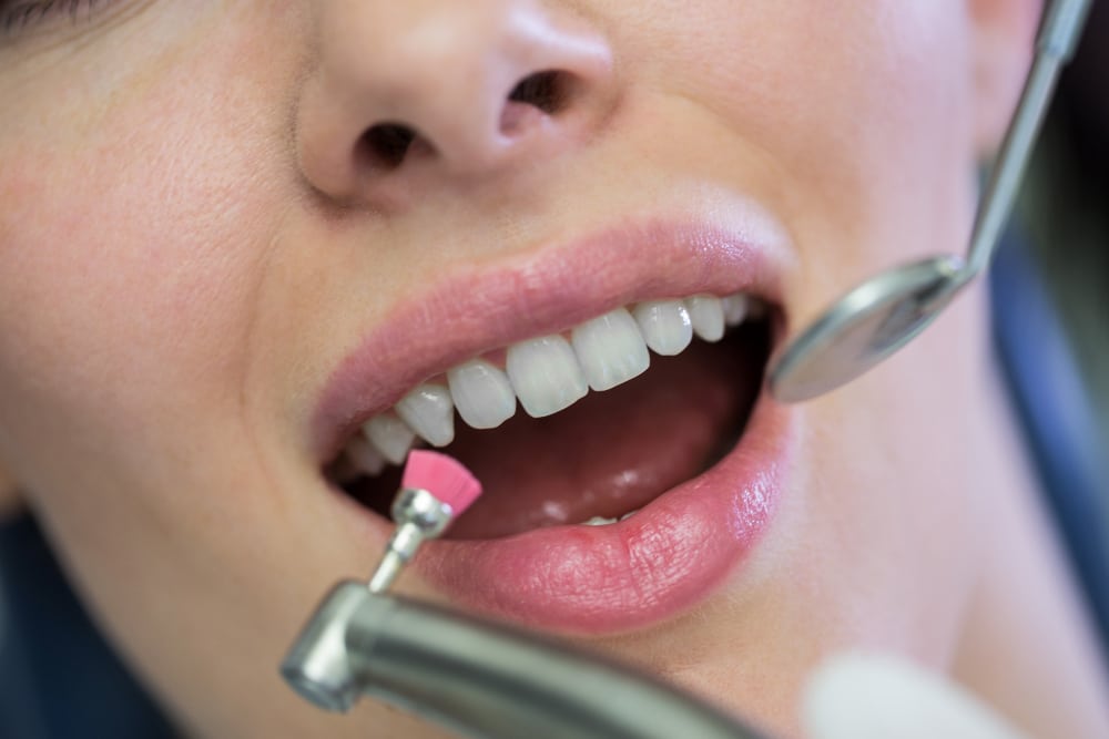Featured image for “Teeth Cleaning and Bad Breath: How to Maintain Fresh Breath”