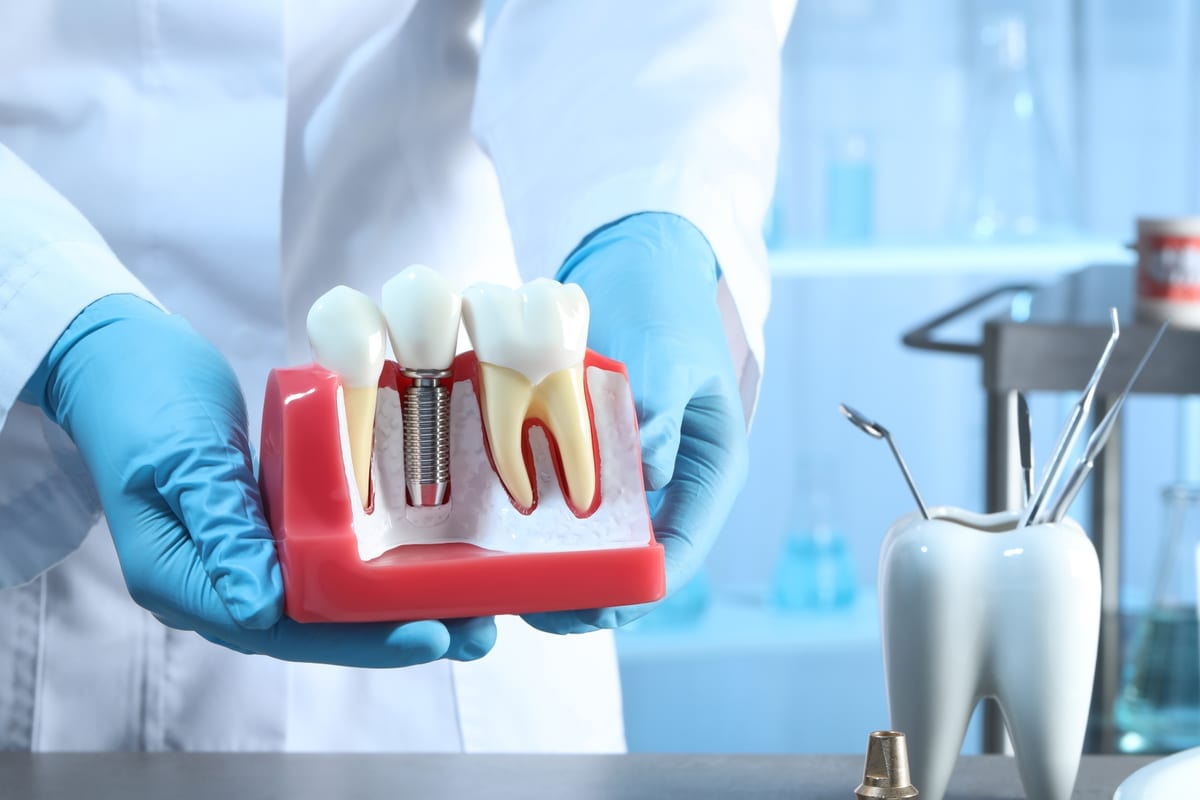 Featured image for “Dental Implant Recovery Guide in Cypress, TX | Emmy Dental”